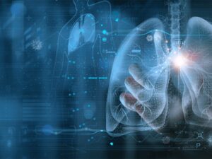 AI intelligenza artificiale