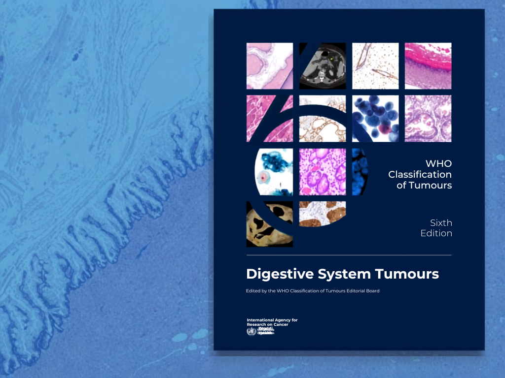 Tumori digestivi, pubblicato il volume 1 della classificazione OMS